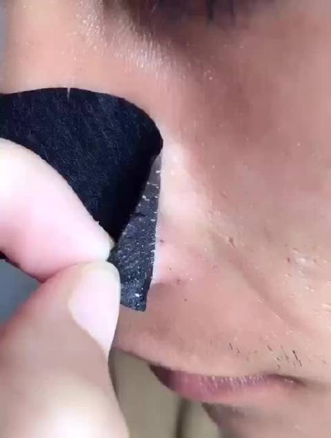 挤黑头最新视频，探索小巷特色小店，黑头治理新秘境揭秘！